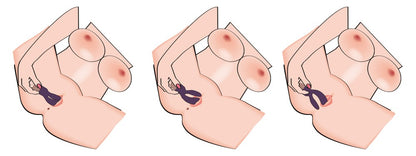Elegant Series Double Vibe in schematischer Anwendungsdarstellung zur gleichzeitigen Stimulation von G-Zone und Klitoris