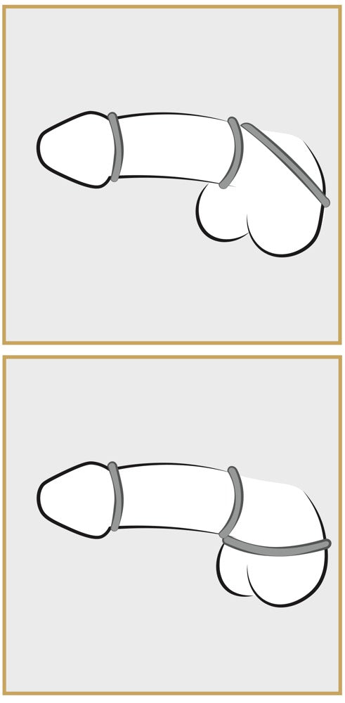 Grafische Darstellung zur Anwendung eines Penisrings
