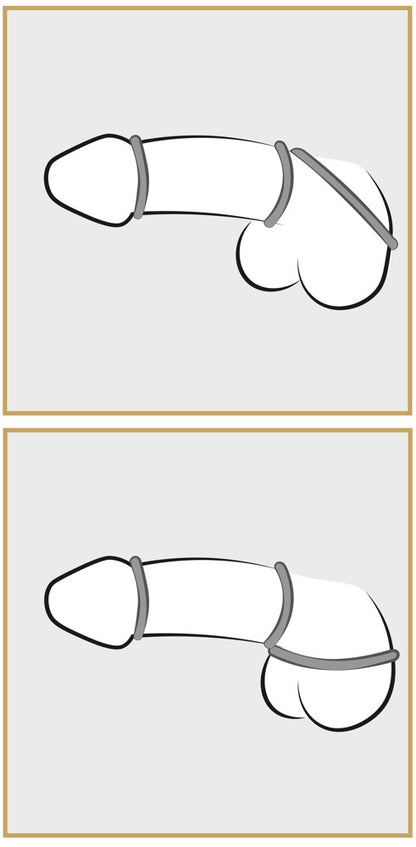 Grafische Darstellung zur Anwendung eines Penisrings