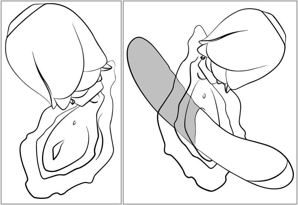 Schematische Darstellung der Anwendung des ROMP Rose Glow