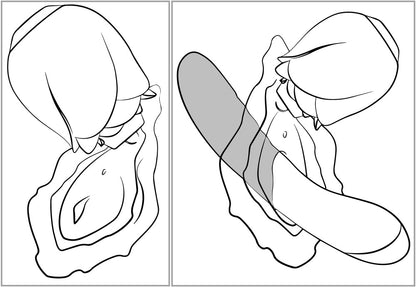 Schematische Darstellung der Anwendung des ROMP Rose Glow