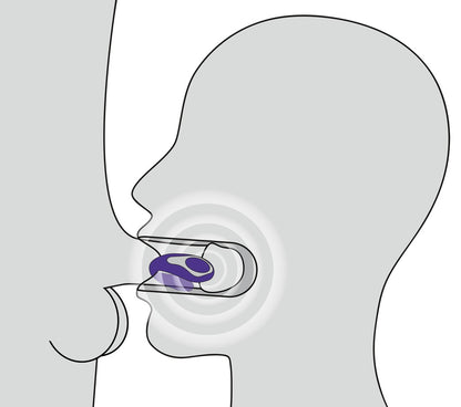 Schematische Darstellung der Anwendung des Mundvibrators im Wangenbereich